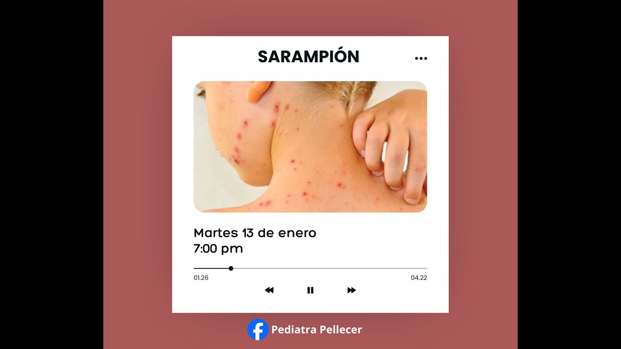 Sarampión: lo que debes saber🩺