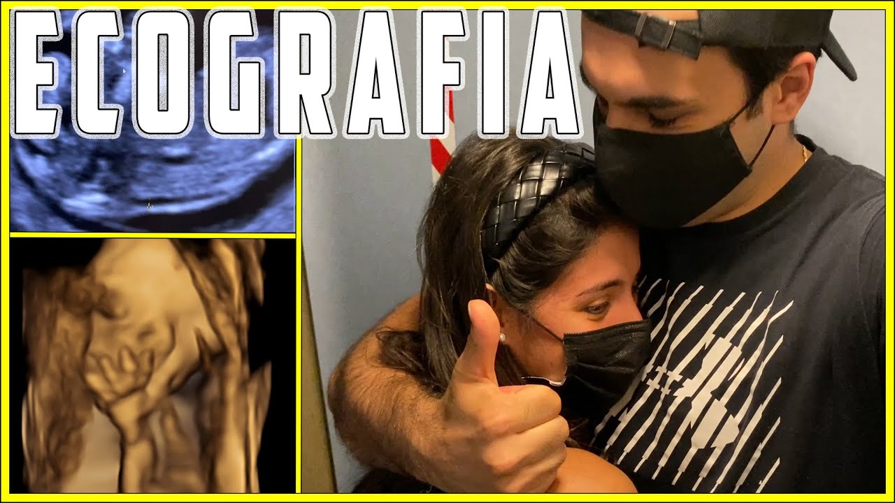 ECOGRAFIE IN GRAVIDANZA! [E poi arrivi tu 2 - La serie]
