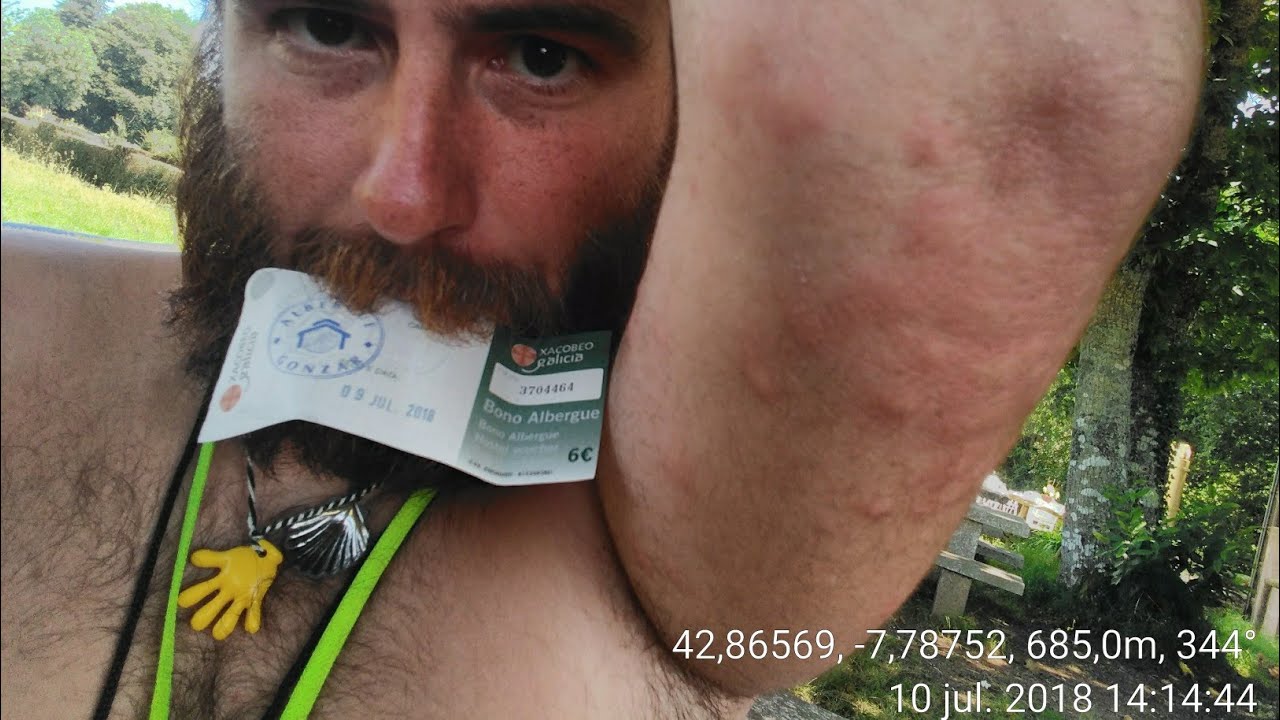 Camino de Santiago Esta es la quinta vez que me pican las chinches BEDBUGS