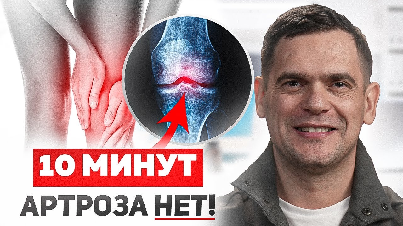 Артроз - это НЕ ПРИГОВОР! Как остановить артроз без операций и лекарств!