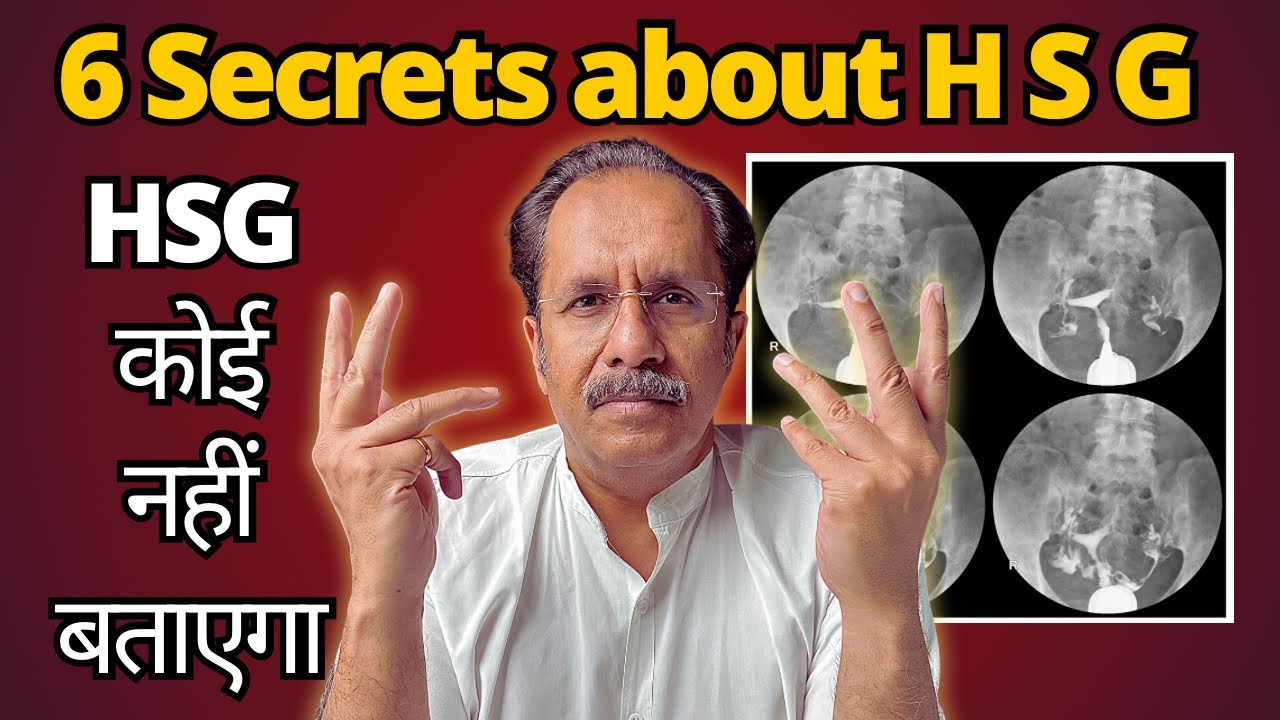 The shocking reality of hysterosalpingogram|Dr.Sunil Jindal|Jindal Hospital Meerut