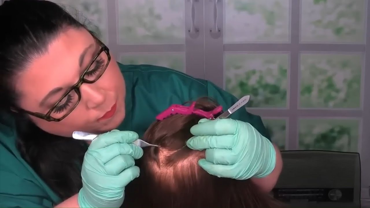ASMR Scalp Check with Bad Results (Tweezers, Scalp Treatment, Scalp Massage) Medical Roleplay