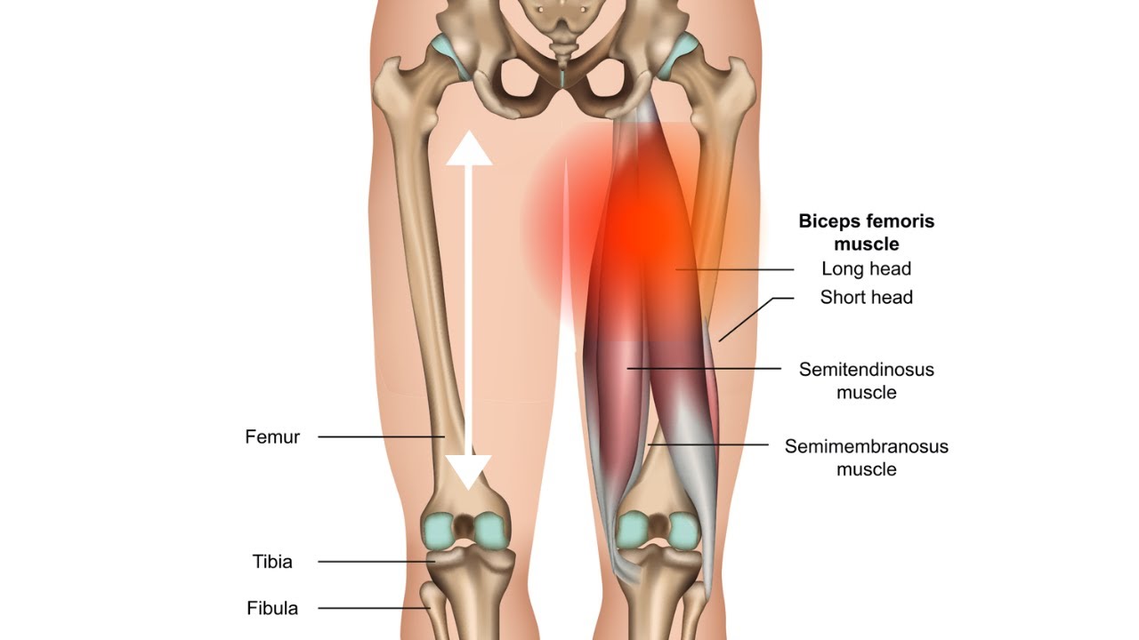 Hamstring Muscles - Trigger Point Anatomy