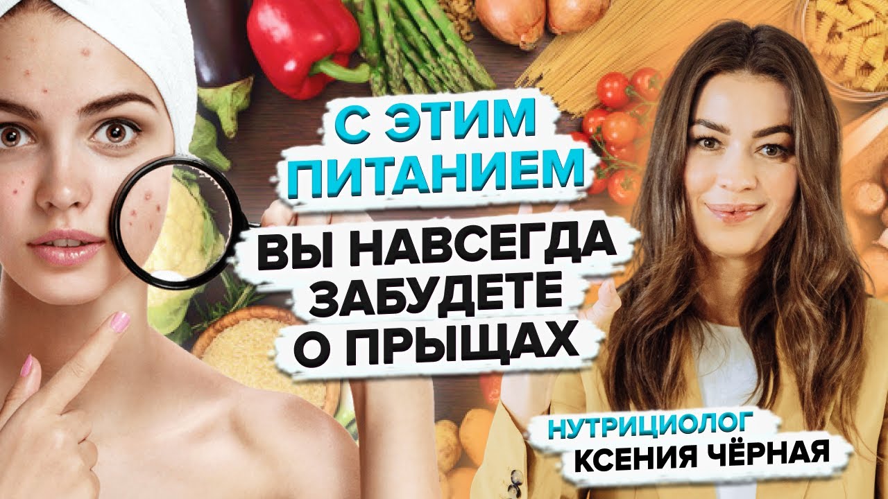 Как избавиться от прыщей? Как очистить кожу? Акне и питание. Советы нутрициолога Ксении Глинкиной