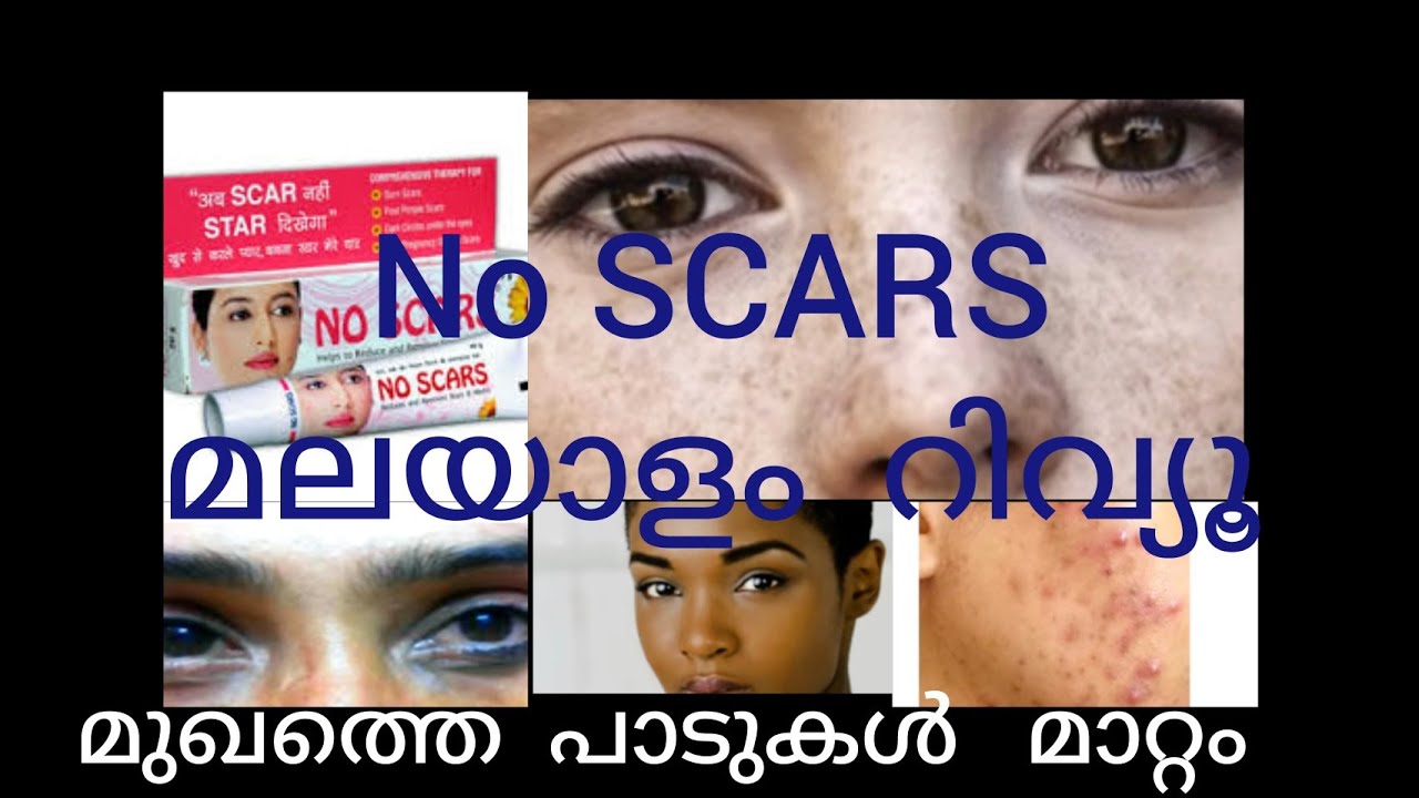NO SCARS മലയാളം റിവ്യൂ  മുഖത്തെ പാടുകൾ മാറ്റം