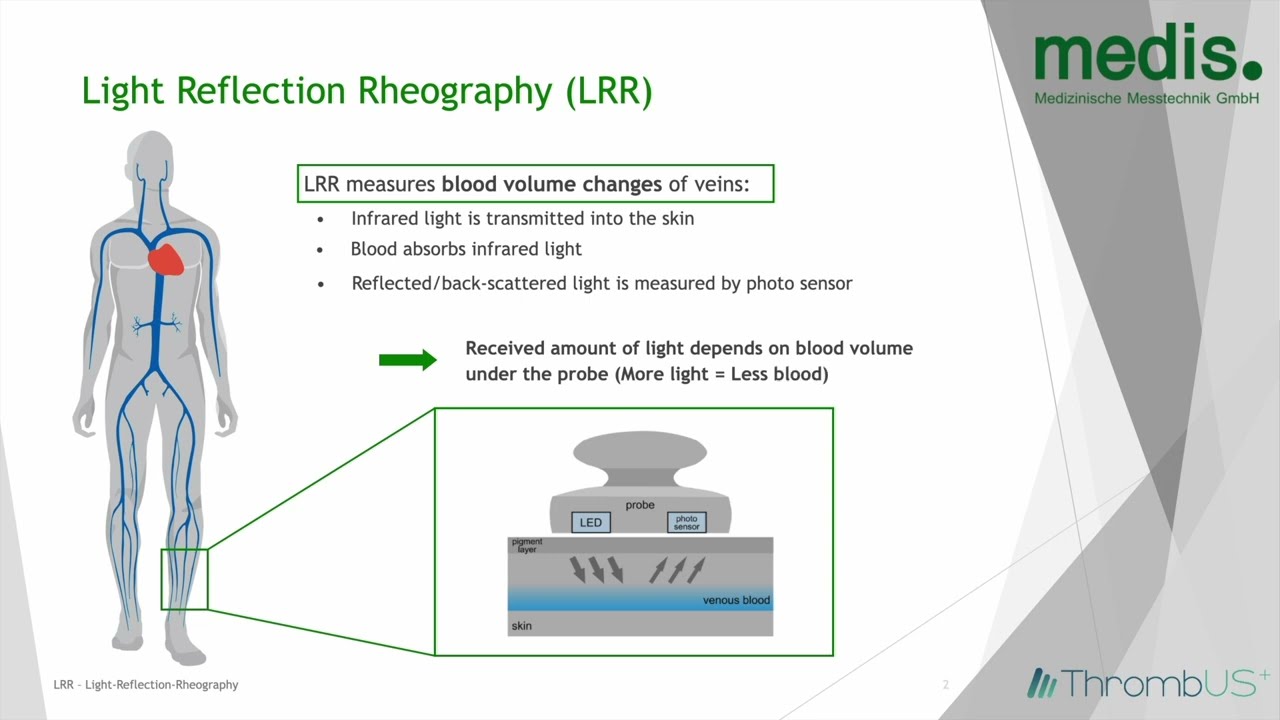 What is Light Reflection Rheography?