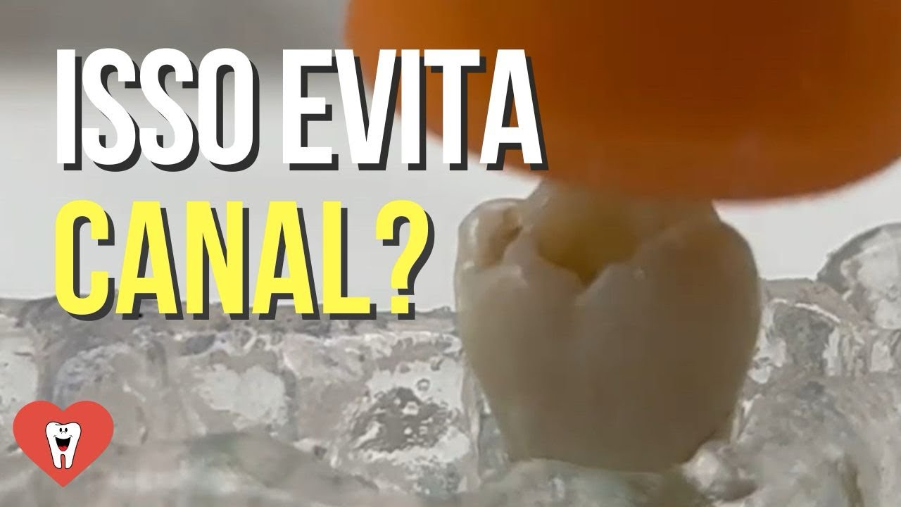 PROTOCOLO PARA EVITAR CANAL EM CAVIDADE PROFUNDA - Endolovers
