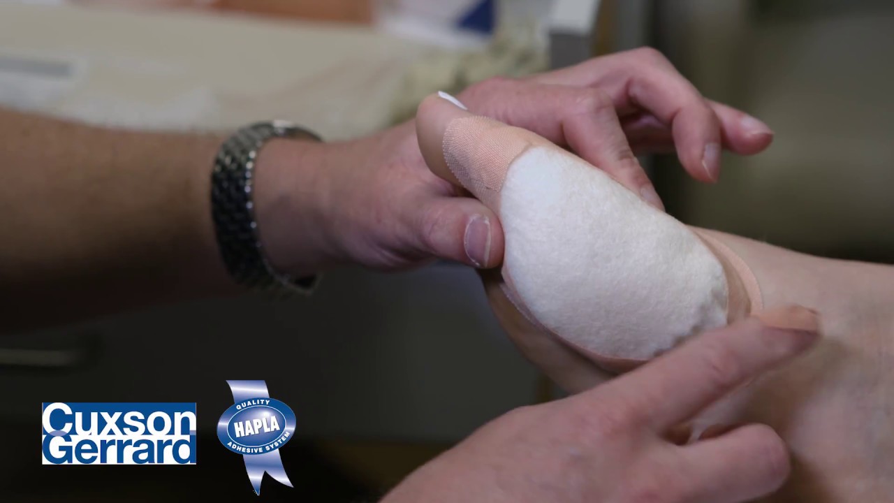 The Hallux Abducto Valgus Cavity Pad