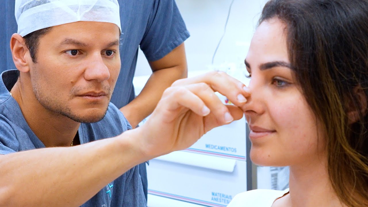Rinoplastia com Frederico Keim l Pré Operatório, Hospital Blanc, Melhor Cirurgião do Brasil - Parte1