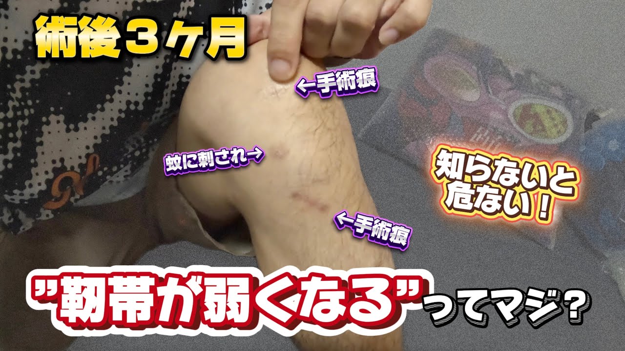 【3ヶ月で気づいた】前十字靭帯手術後、“最初のリハビリ”の意味