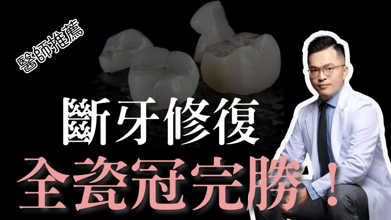 牙齒斷裂怎麼辦？全瓷冠拯救你的笑容！