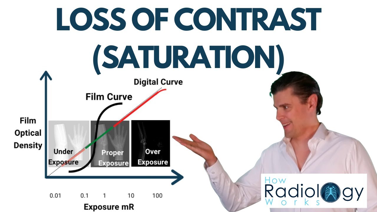 X-ray Saturation (Loss of Contrast)