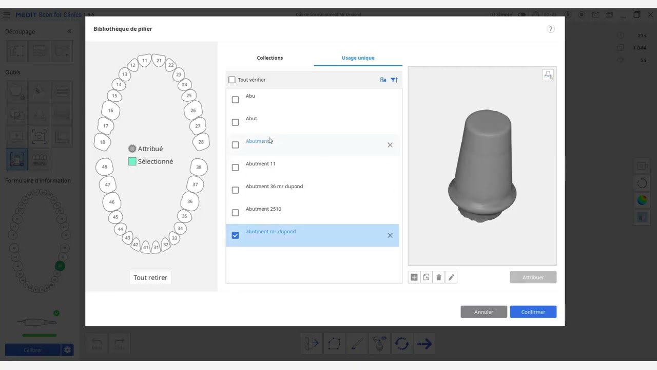 Scanner et aligner un pilier implantaire, la fonctionnalité 