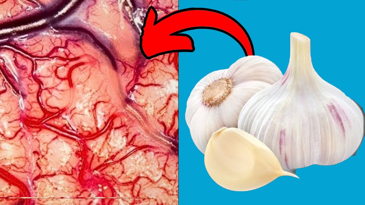 Ешьте чеснок перед сном и БУДЬТЕ ВНИМАТЕЛЬНЫ, ЧТО ПРОИСХОДИТ💥(Почти никто не знает)🤯