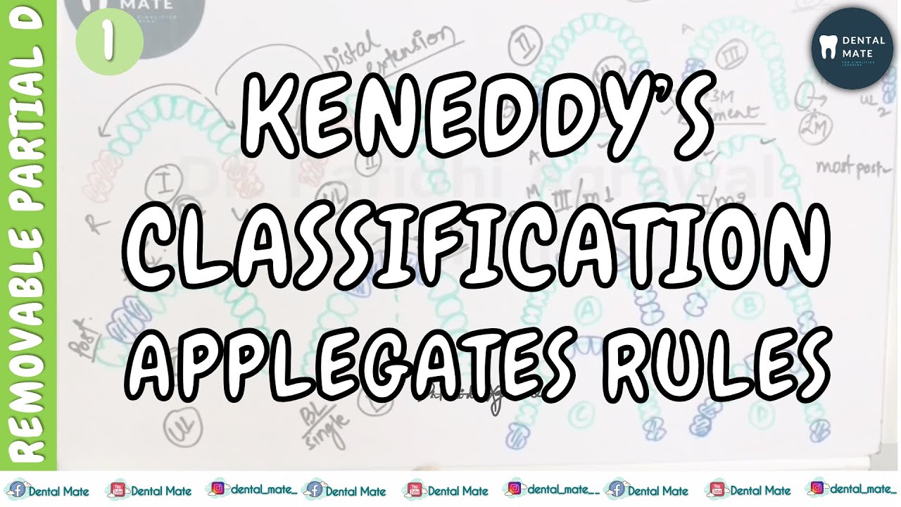 Kennedy’s Classification | Applegates rules | Removable Partial Denture | Dr Paridhi Agrawal