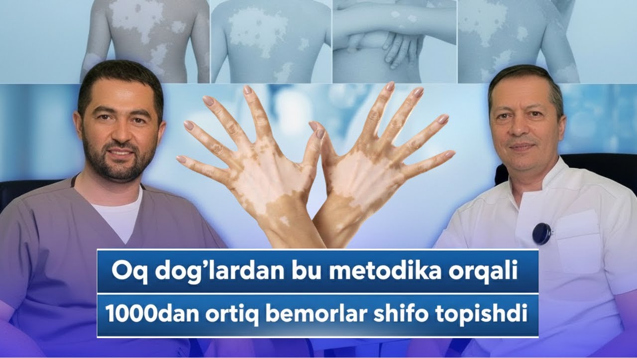 Oq dog'lardan bu metodika orqali 1000dan ortiq bemorlar shifo topishdi | Vitiligo davosi