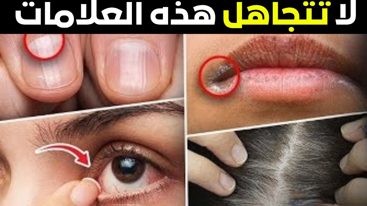 جسمك يحذرك من 10 علامات  نقص صحي يجب الانتباه له _ معلومات صحية مفيدة _ أعراض نقص الفيتامينات،,