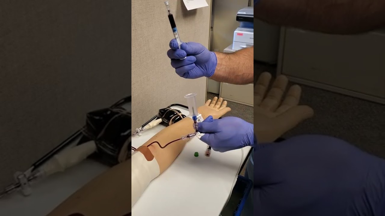 ABG draw from a-line using a vacutainer and waste tubes