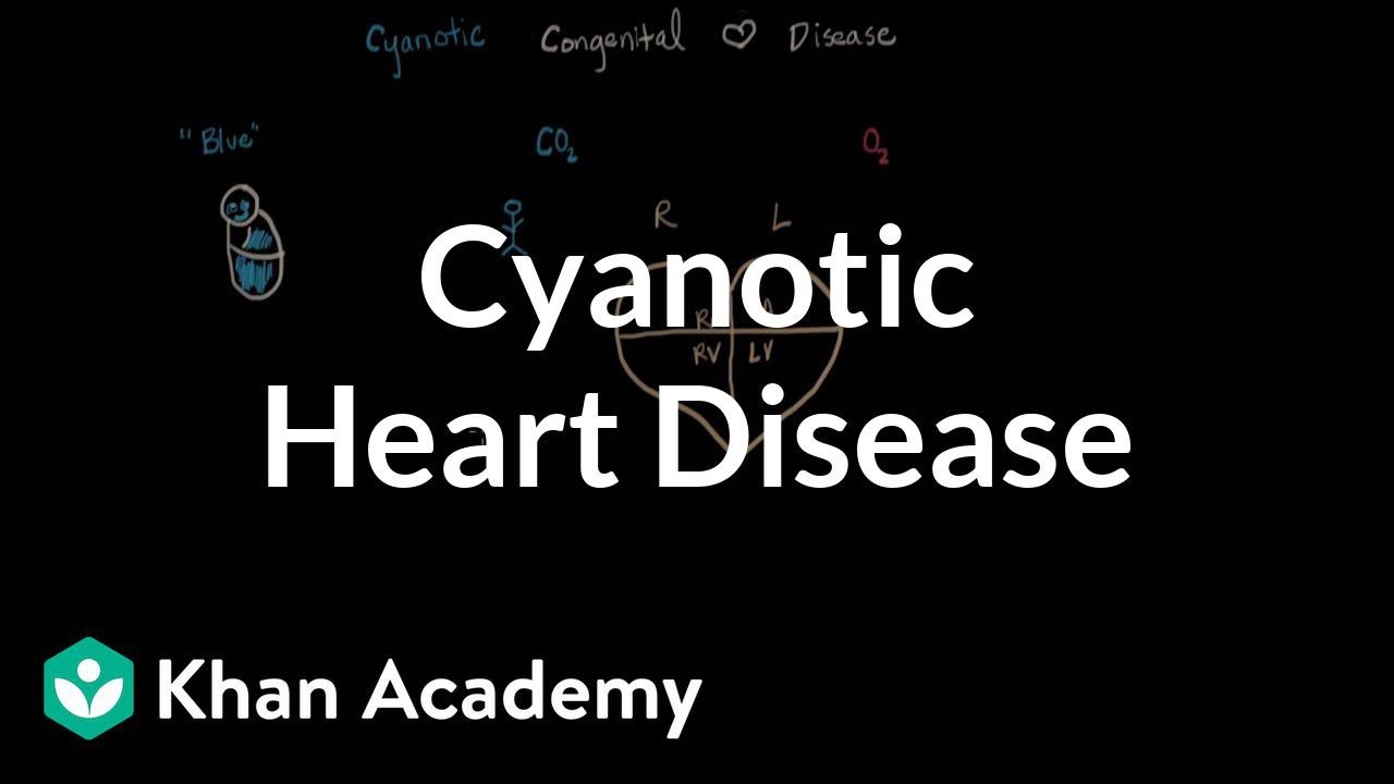 What is cyanotic heart disease | Circulatory System and Disease | NCLEX-RN | Khan Academy