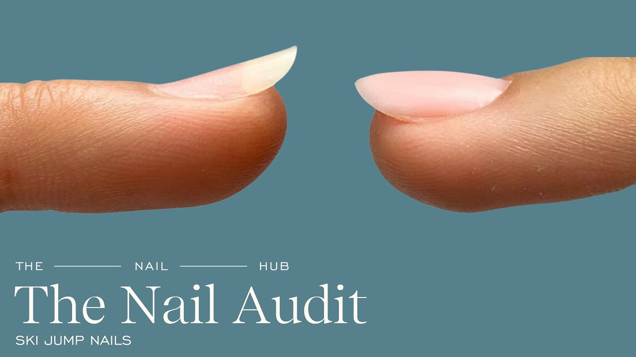 How to Fix Ski Jump Nails Step by Step Guide for Upward Growing Nails