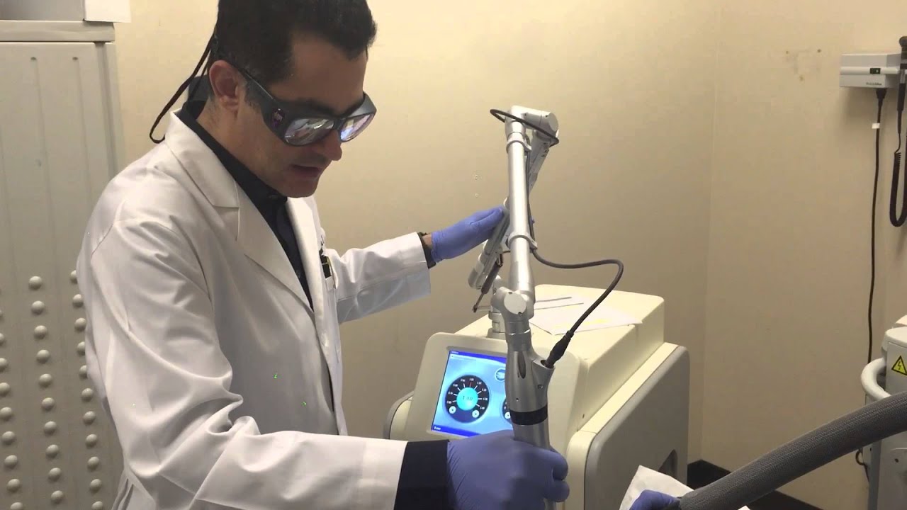 Picoway laser tattoo removal