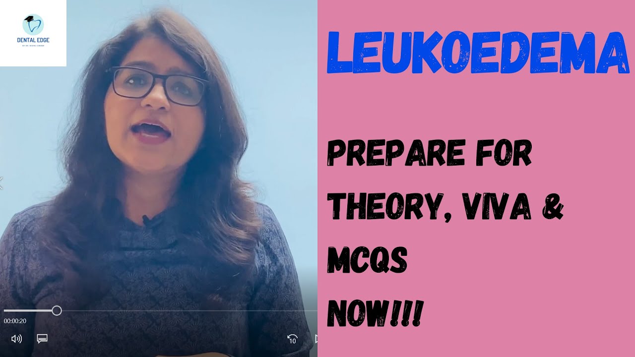 LEUKOEDEMA I BENIGN & MALIGNANT TUMORS OF ORAL CAVITY I ORAL PATHOLOGY