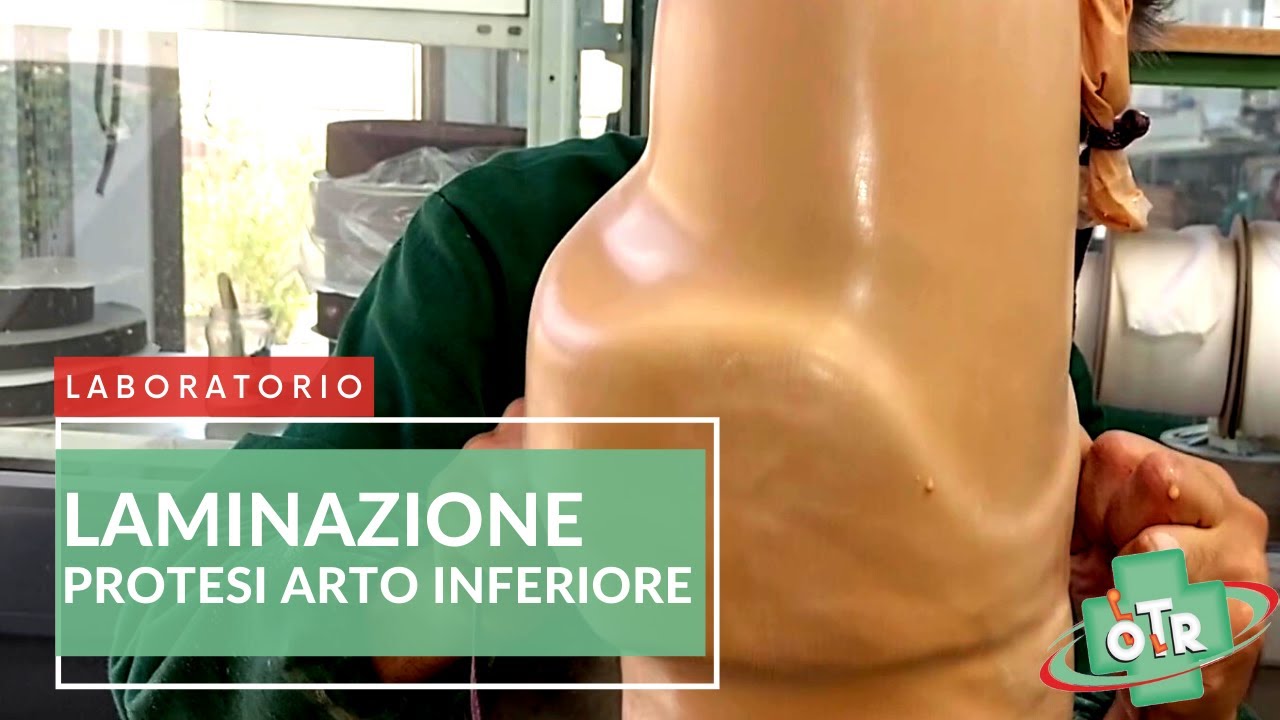OTR Ortopedia - LABORATORIO - Una parte del processo di Laminazione Protesi Arto Inferiore