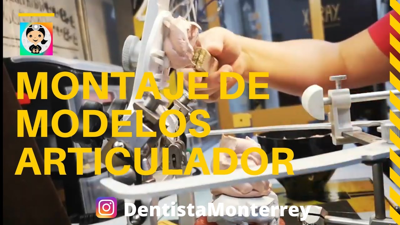 ⏭️ MONTAJE de MODELOS 👅 QuickVideo Articulador SemiAjustable #Whipmix #dental