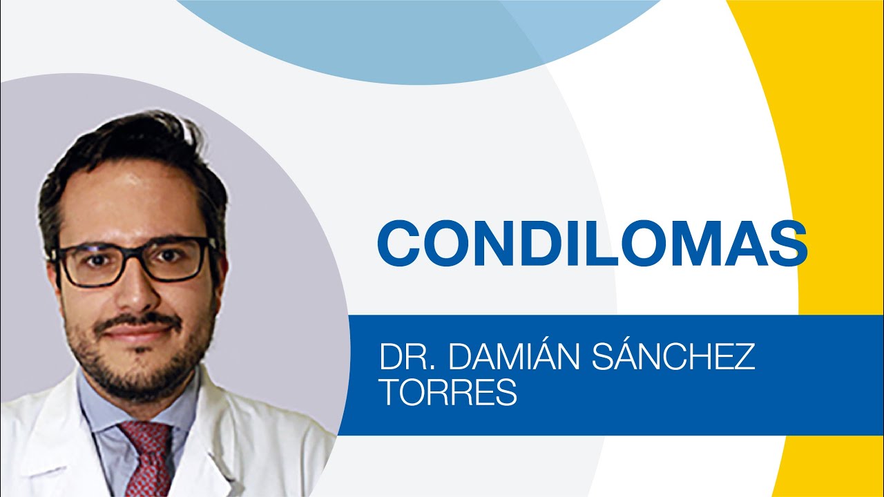 Condilomas o verrugas genitales: síntomas y tratamiento