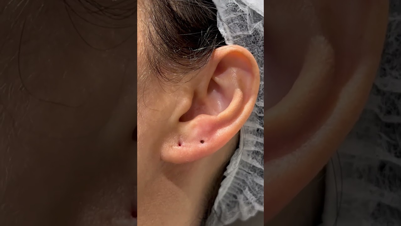 15 anos sem tirar a joia, ent&atilde;o vamos limpar.#shortsvideo #shorts #limpeza #piercing