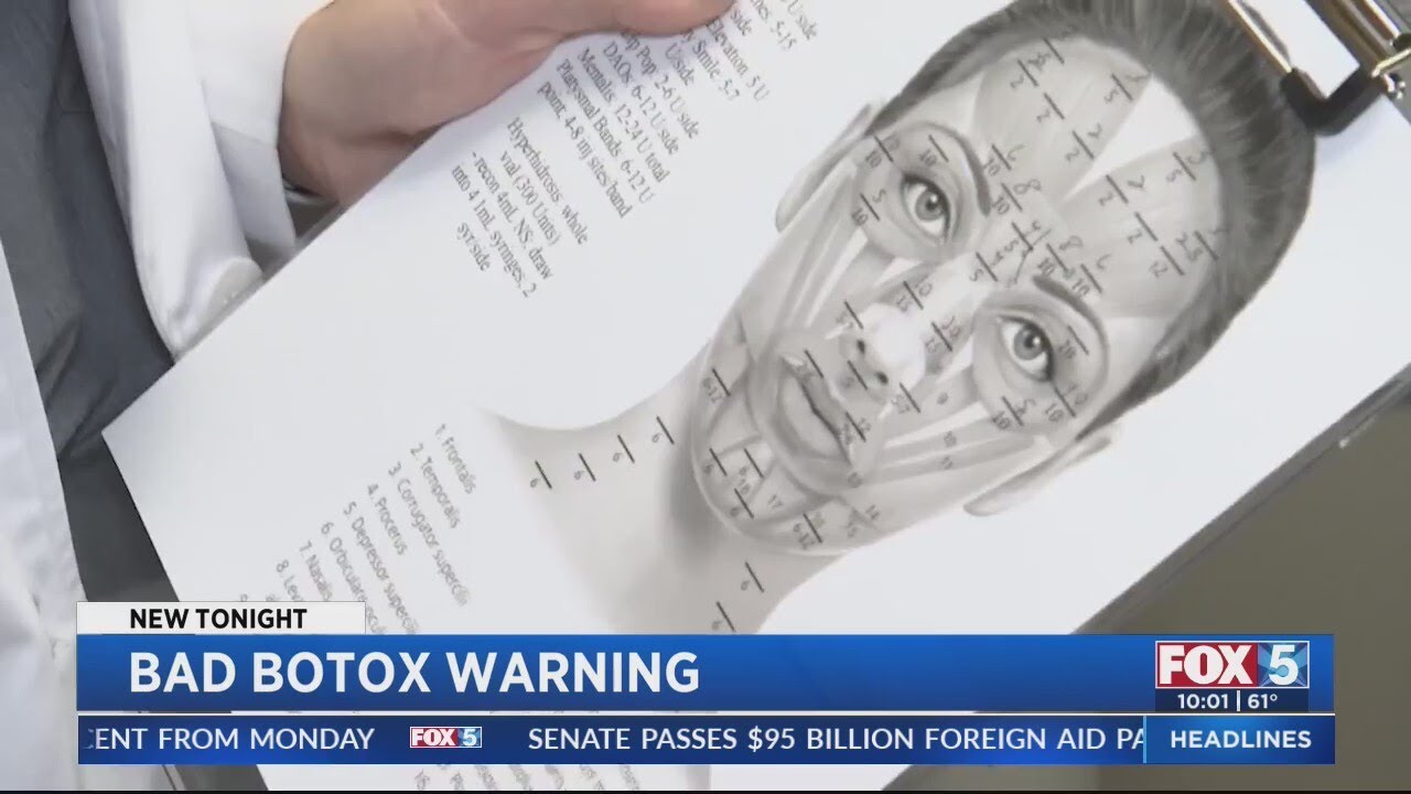 San Diego woman suffers botulism