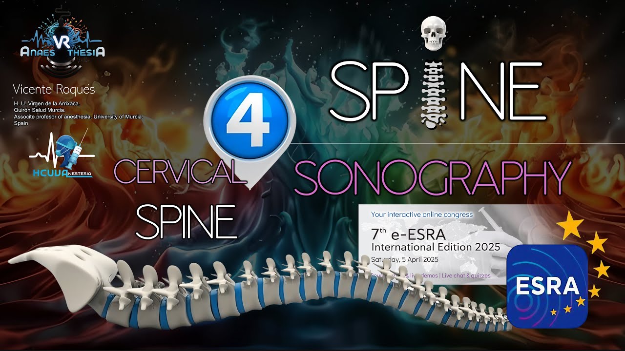 SPINE SONOGRAPHY. PART 4 (CERVICAL SPINE)