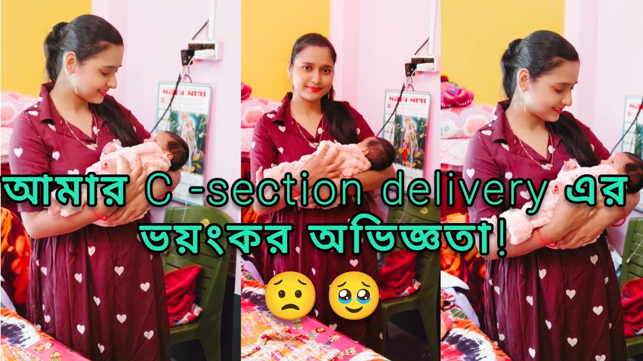 আমার C -section delivery এর অভিজ্ঞতা কেমন ছিল🤔 এমন পরিস্থিতির সম্মুখীন হতে হবে ভাবিনি 😟