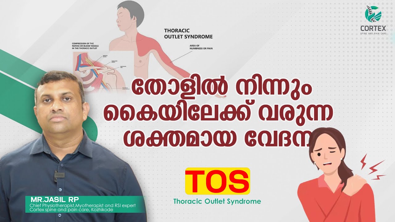 തോളിൽ നിന്നും കൈയിലേക്ക് വരുന്ന ശക്തമായ വേദനക്ക് കാരണം ഇതാണ്, ഈ വ്യായാമങ്ങളിലൂടെ മാറ്റിയെടുക്കാം