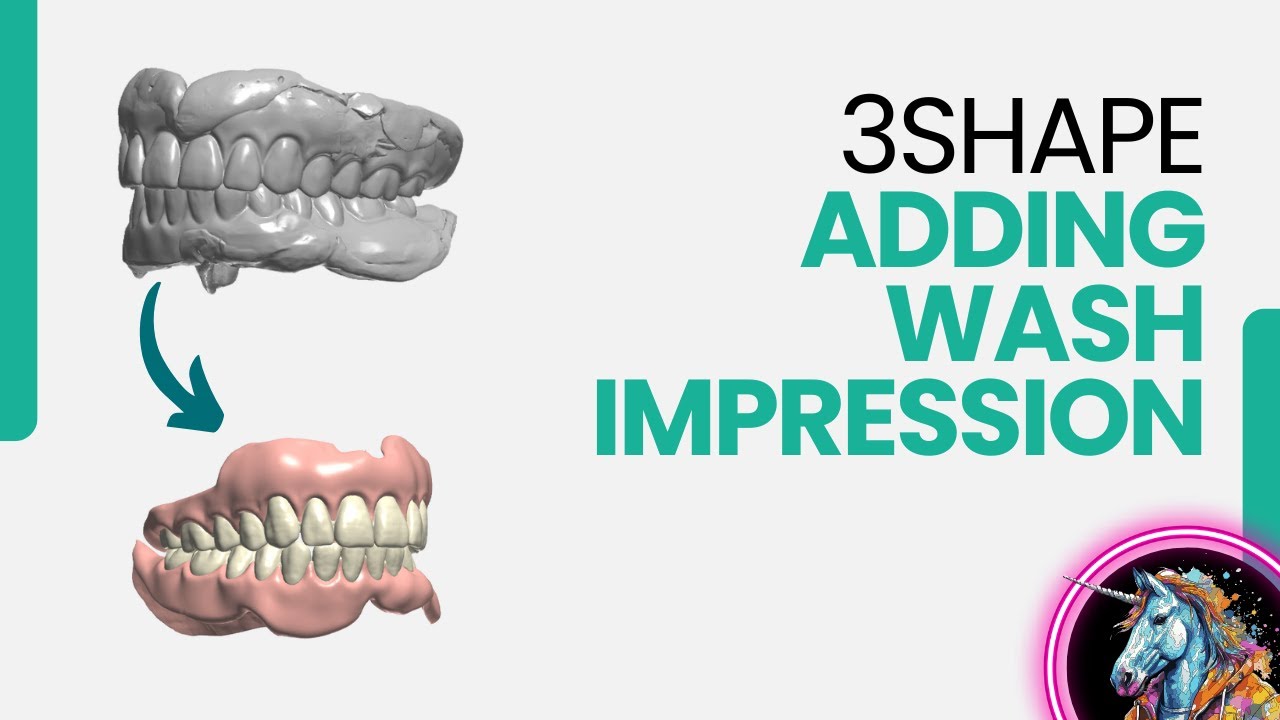 3Shape Denture Design: Adding a Wash Impression