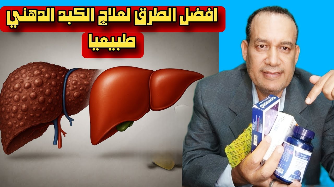 الكبد الدهني عند مرضى السكري: دراسة طبية تكشف علاجات طبيعية فعالة!