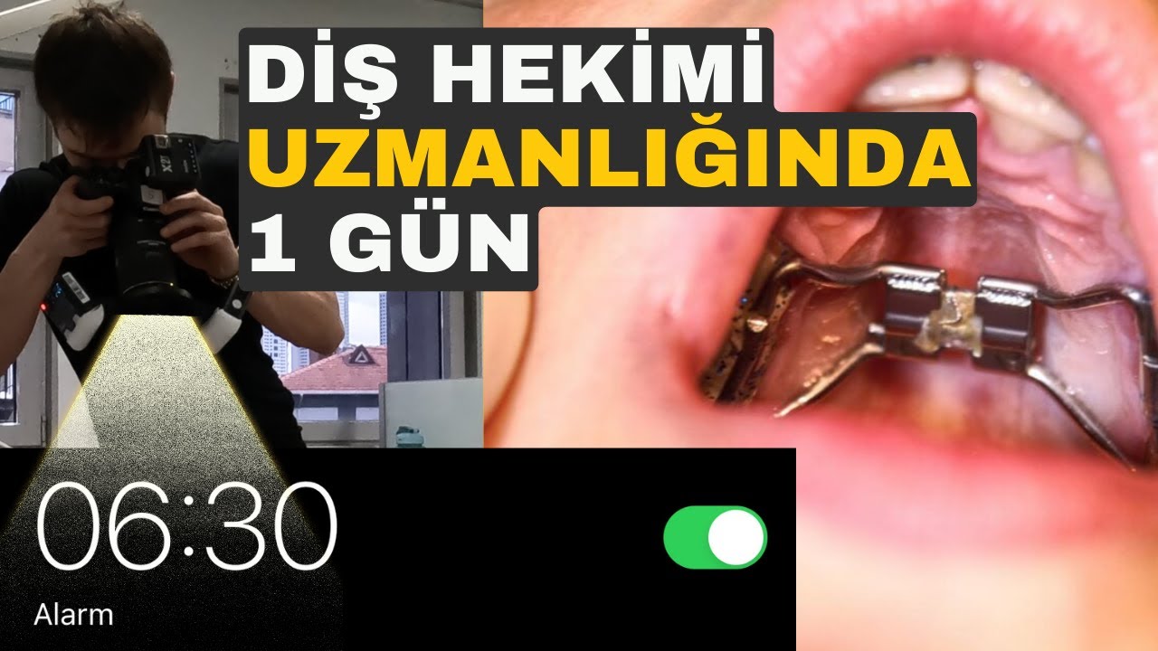 ORTODONTİ UZMANLIĞINDA 1 G&Uuml;N #VLOG