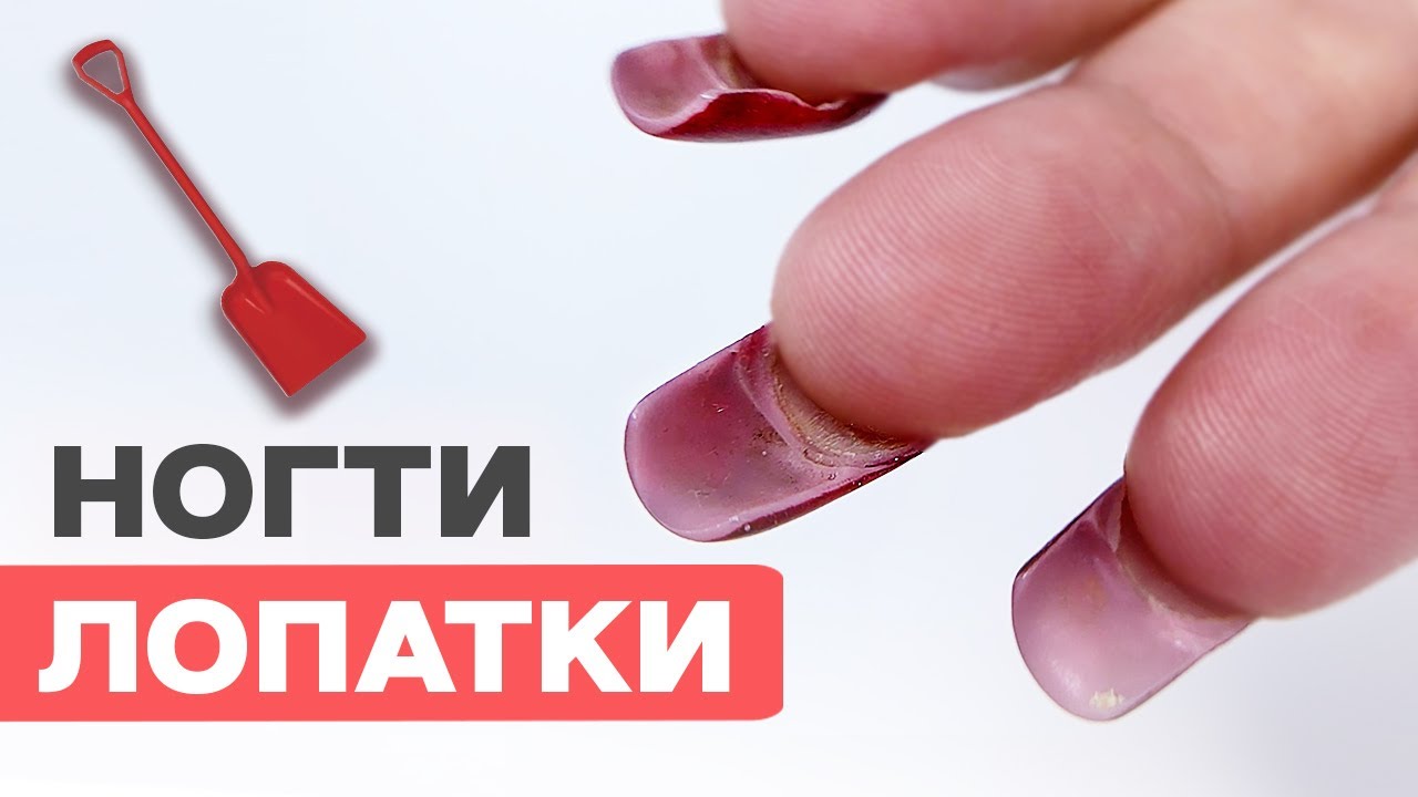 НЕ делай эти ОШИБКИ верхних форм | Ступеньки