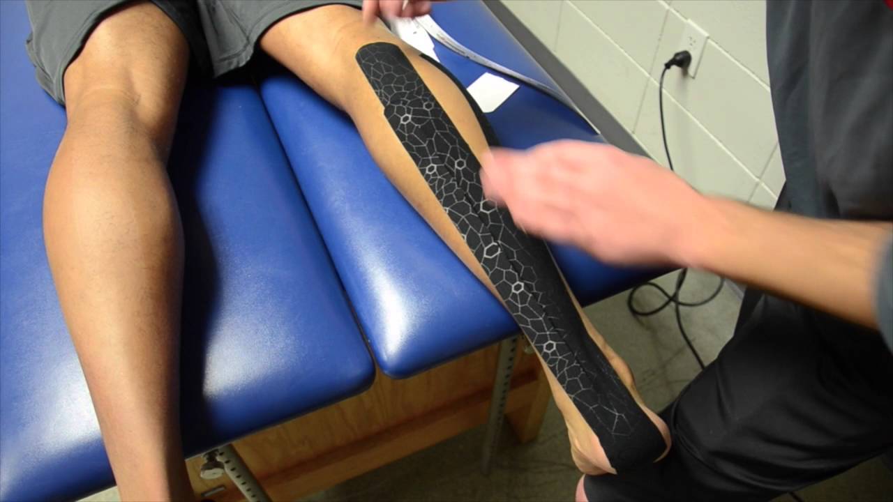 Calf Strain/Achilles Kinesiology Taping - University of Florida