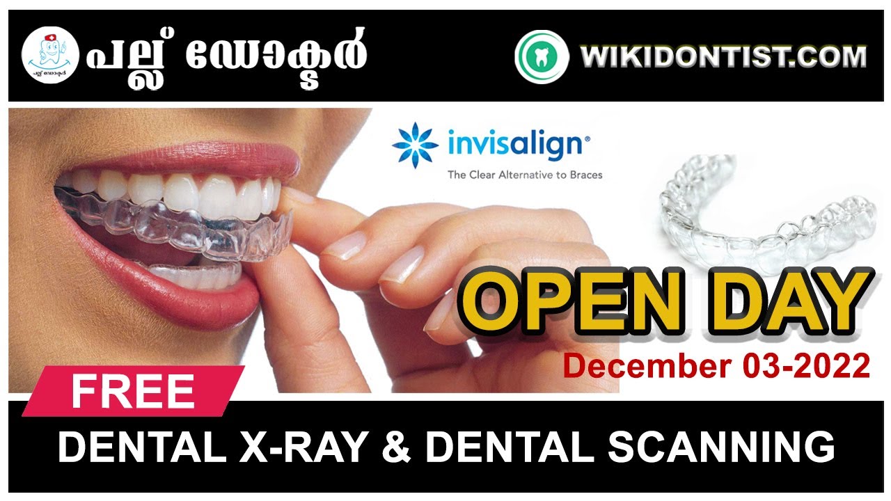 Invisalign OPEN DAY....03-12-2022...at Nechupadam Dental ClinicMarine Drive Kochi..Book Your Seats..