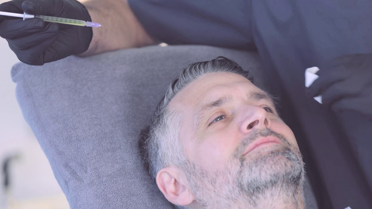 Exokine Behandlung-Unicorn Lift (Dr. Tobias Kurz Med Esthetic) Anti Aging
