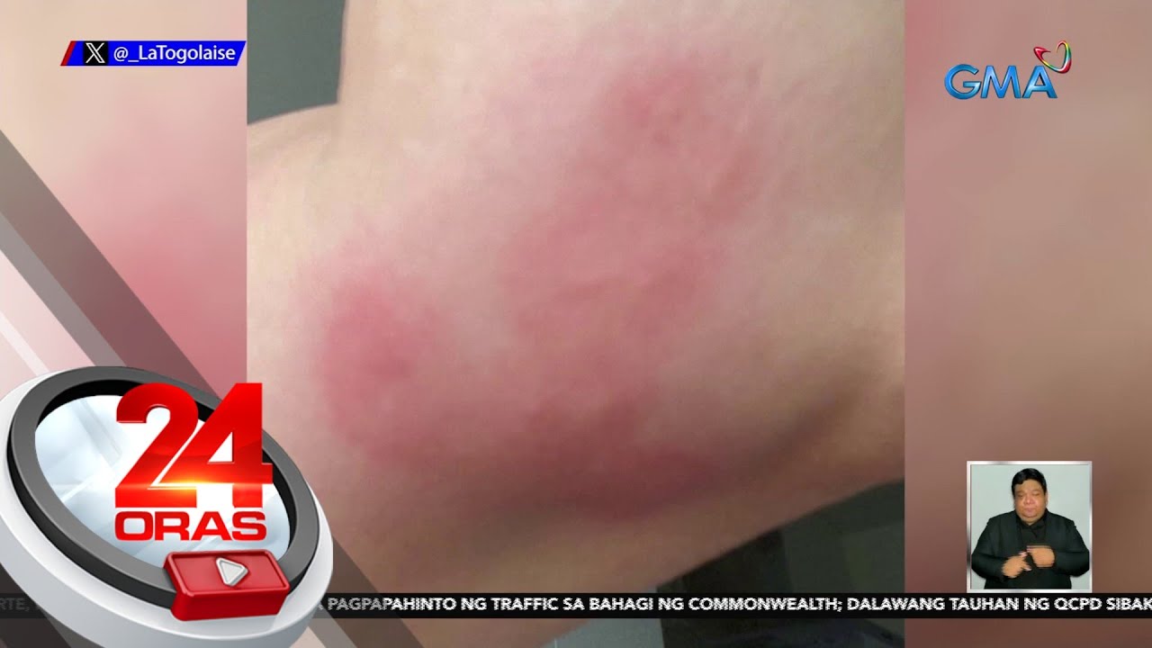 Mga surot, namemerwisyo sa France | 24 Oras