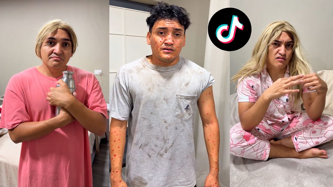 ME ATACAR0N LAS ABEJAS CASI MUER0- LOS TIK TOK MAS VIRALES de ATILIO LARIN