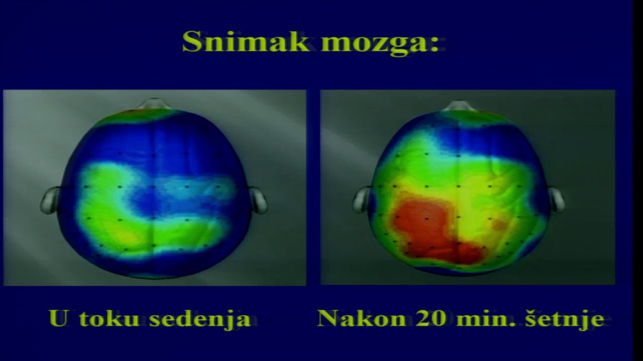 Kako da poboljsamo rad mozga - dr Dragan Ivanov