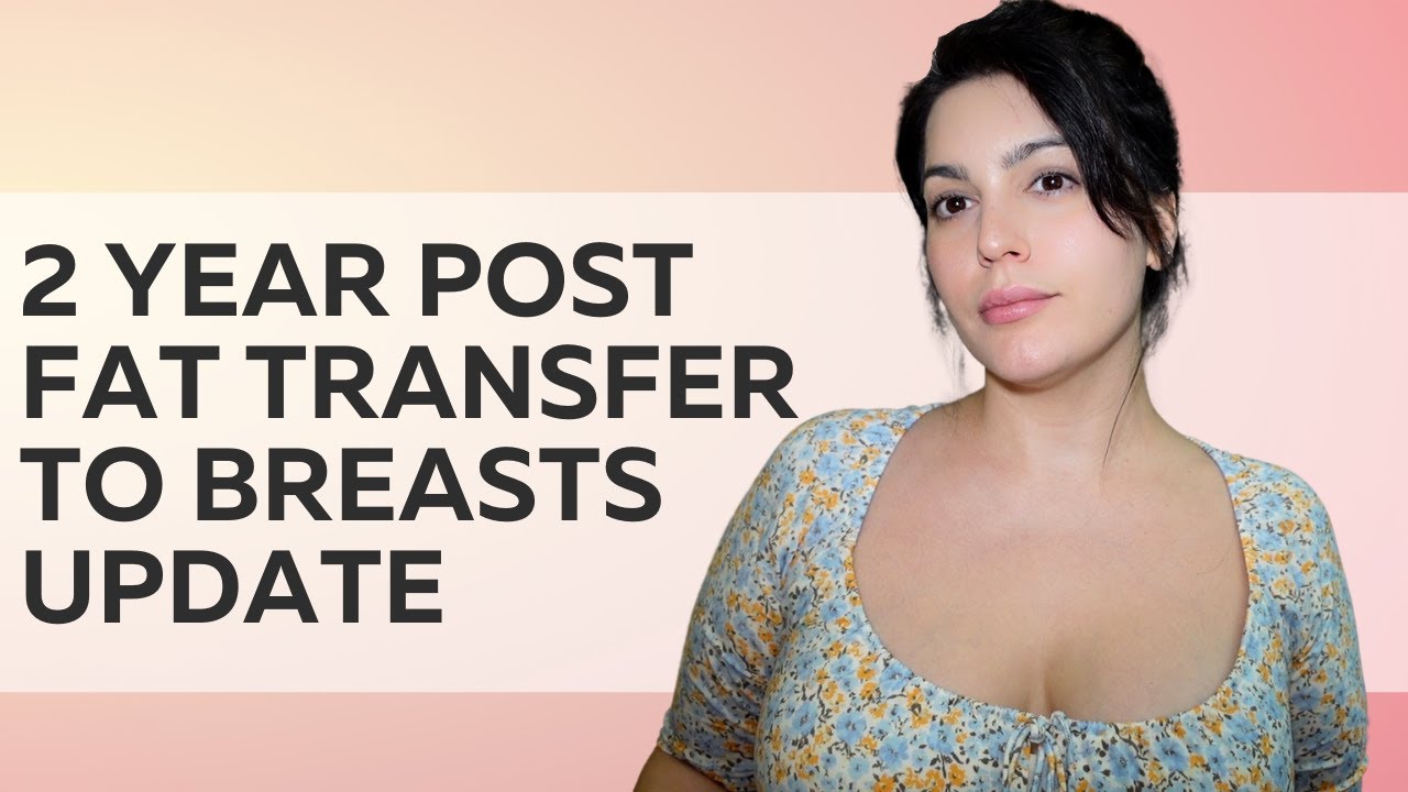 2 YEAR POST FAT TRANSFER TO BREAST UPDATE