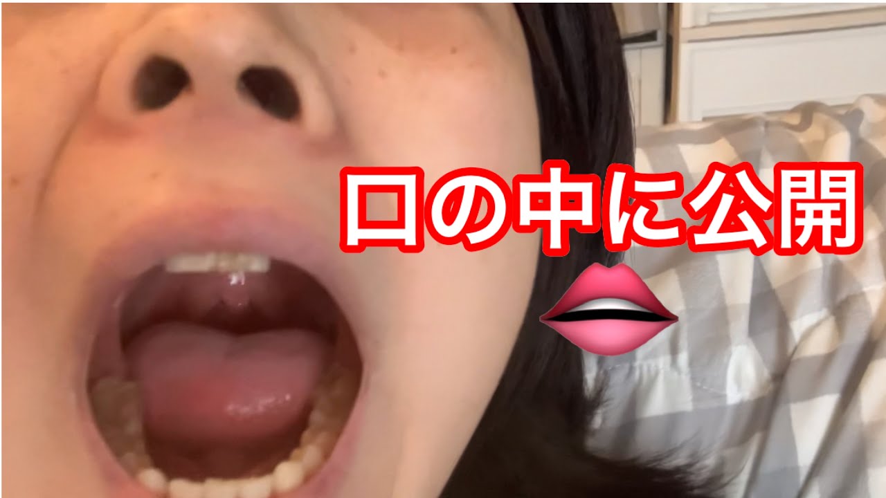 口の中公開しちゃいます！