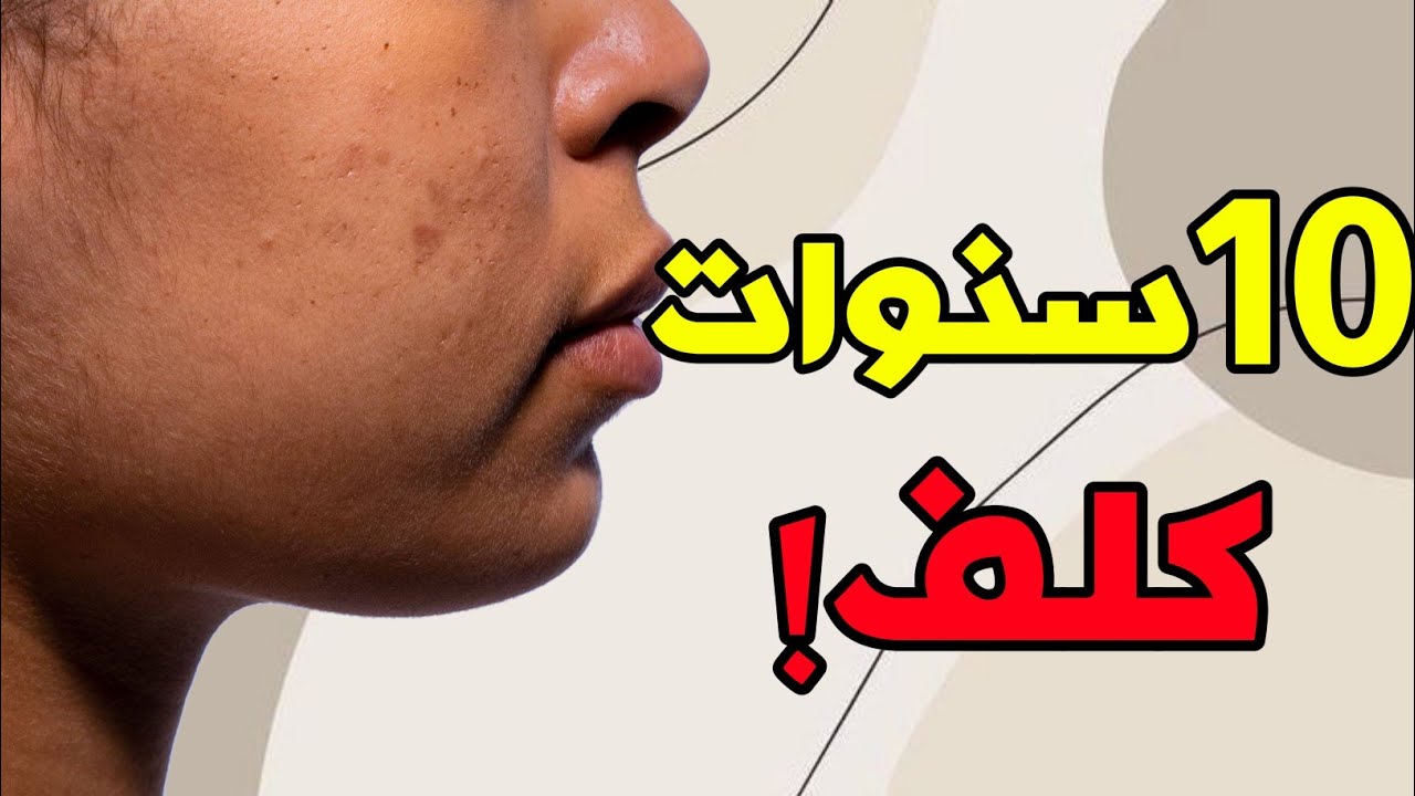 بعد 10 سنوات كلف وجهي تنقى ولا زوين ☺️عجبني بزاااف🤫سبابي شيرلي كنت كنديرها وانا صغيرة 😔