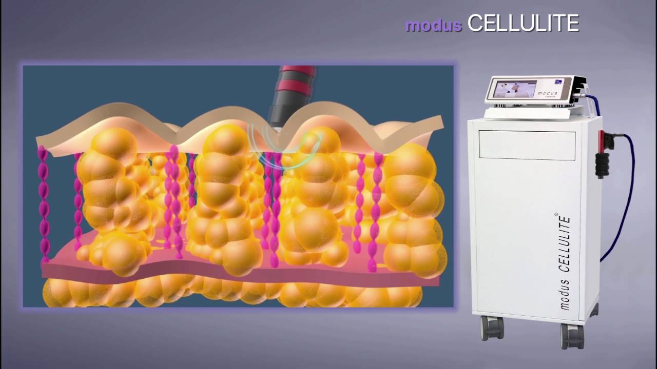 MODUS CELLULITE - AWT (Acoustic Wave Therapy)