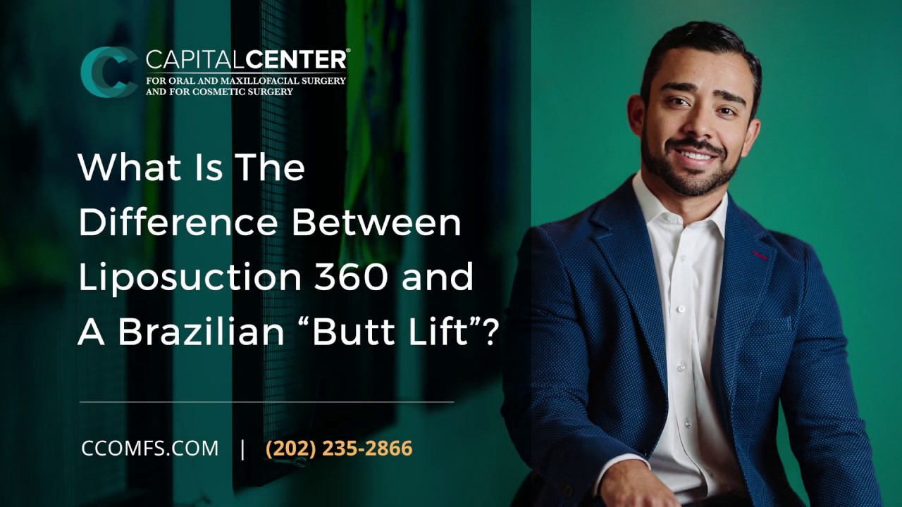What is the Difference Between Liposuction 360 and a Brazilian 