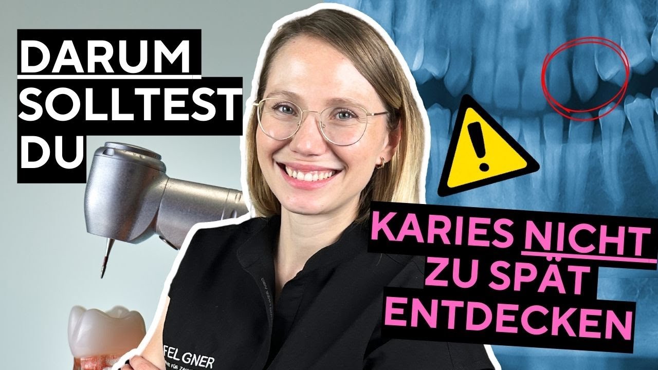 Kariesinfiltration:  Karies ohne Bohren modern behandeln